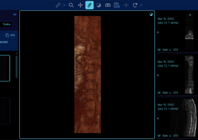 Software RIS PACS con inteligencia artificial