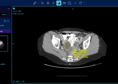 Software RIS PACS con inteligencia artificial