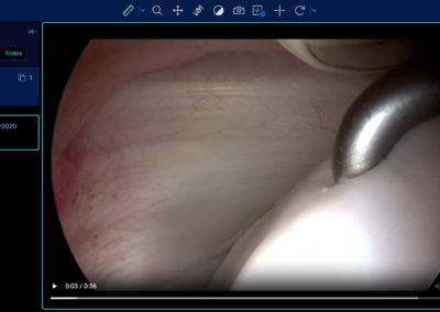 Software RIS PACS con inteligencia artificial