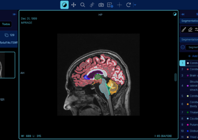 Software RIS PACS con inteligencia artificial
