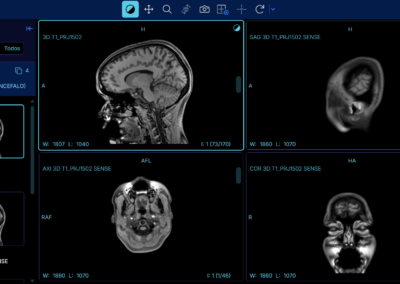 Software RIS PACS con inteligencia artificial