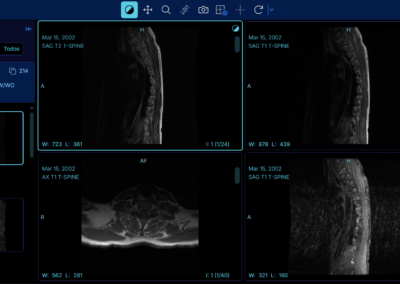 Software RIS PACS con inteligencia artificial