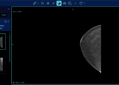 Software RIS PACS con inteligencia artificial