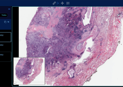Software RIS PACS con inteligencia artificial