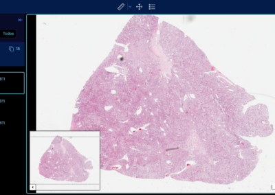 Software RIS PACS con inteligencia artificial