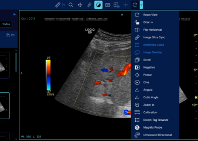 Software RIS PACS con inteligencia artificial
