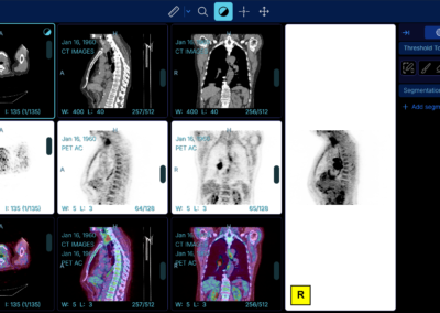 Software RIS PACS con inteligencia artificial