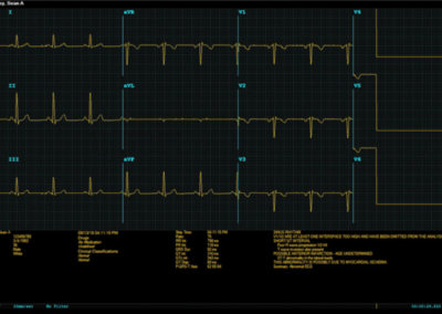 ECG Telemedicina