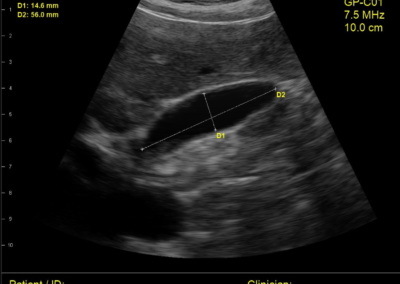 Ultrasonido Telemedicina Diagnostica